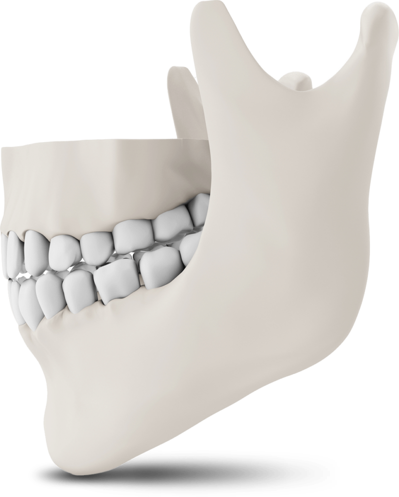 jaw bone model The Oral Surgery Group